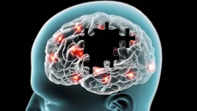 Alzheimer and Leg Exercises
