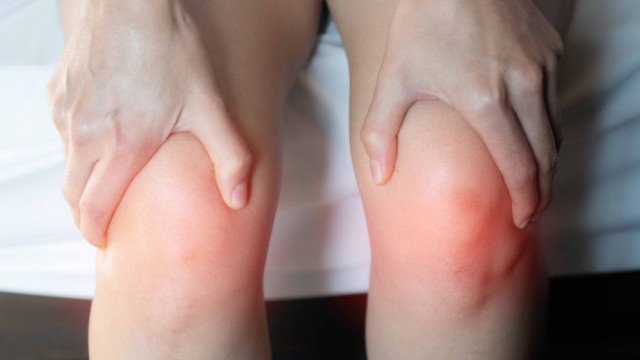 Arthritis in women