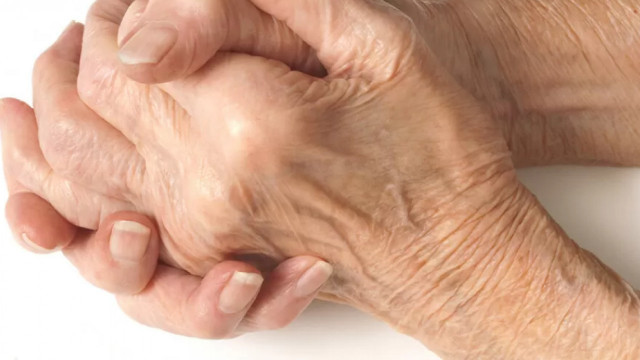 Relief from arthritis