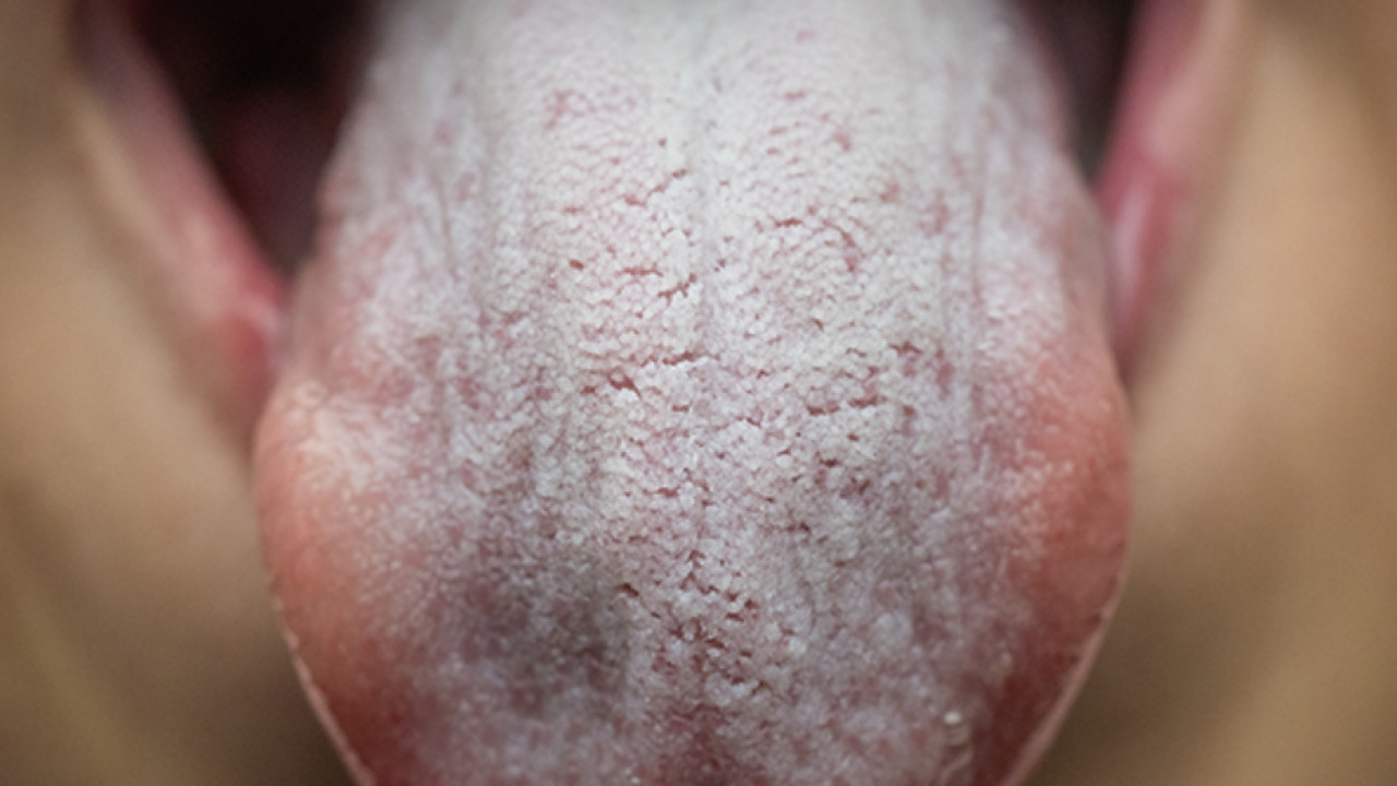 Dry mouth at night